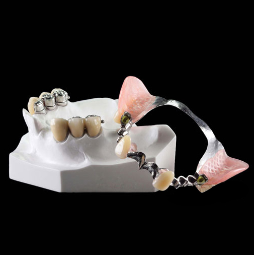 Matt Color Coated Steel Dental Disilicate Lithium -
Precision attachments – Foo Tian detail pictures