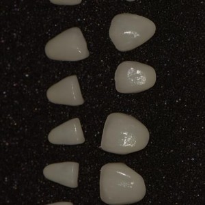Metal Sheet Supplier Zirkonzahn Prettau Zirconia -
 E-max veneers – Foo Tian