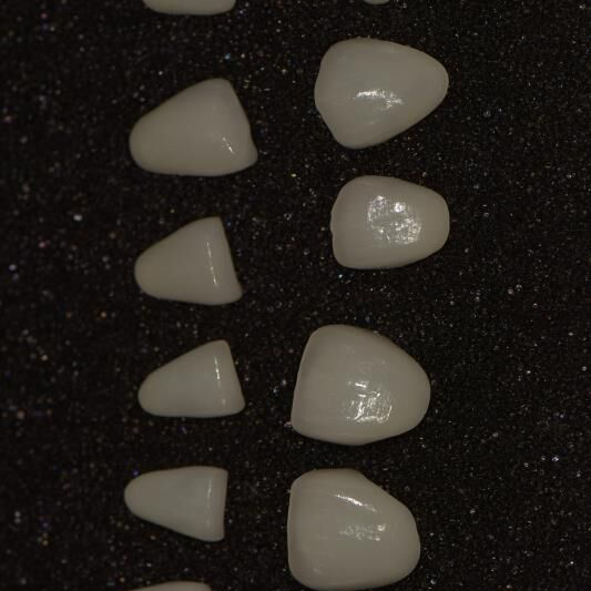 Gl Roofing Steel Zirconia Abutment -
 E-max veneers – Foo Tian