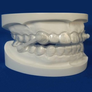 Matt Wrinkle Suface Ppgi Zirconia Dental Implant -
 Anti-snoring appliance – Foo Tian