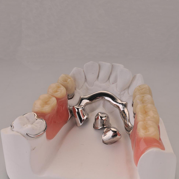 Tinplate Printed Dental Implant Double Ended -
Telescopic work – Foo Tian detail pictures