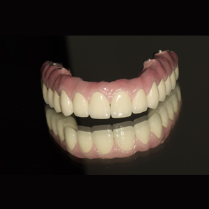 Blue Anodized Aluminum Plate Dental Laboratory Materials - Dental implant work – Foo Tian