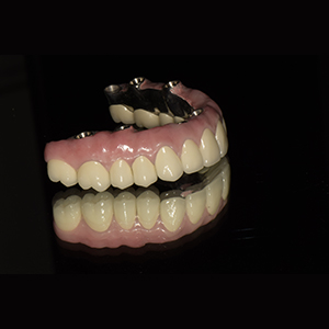 Dental implant work