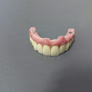 Zinc Coated Steel Coil Denture Box -
 Screwed Retained Full Arch Implant bridge case – Foo Tian