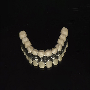 Matt Pre-Painted Steel Dental Composite Restoration - Zirconium inner cores over metal structure of full arch implant bridge – Foo Tian