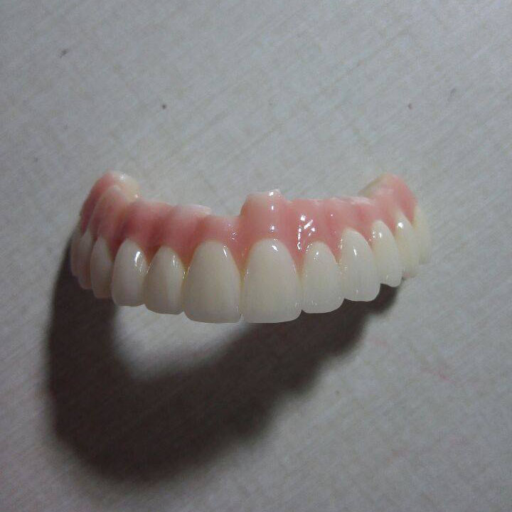 Printing Tinplate Sheets Low Handpiece -
full arch Zirconia implant bridge – Foo Tian detail pictures