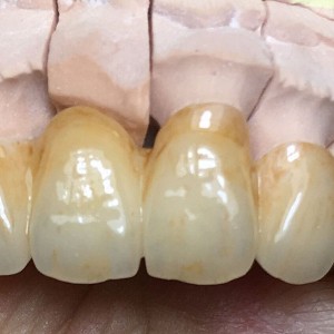 Zirconia buundada