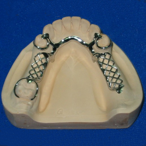 Black Iron Steel Coil The Dentistry -
 cast partial framework – Foo Tian