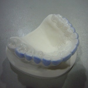 Aluminum Steel Sheet Dental Implant Abutment -
 bleaching tray – Foo Tian