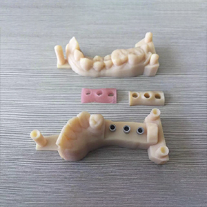 digital 3D printed model for implant work